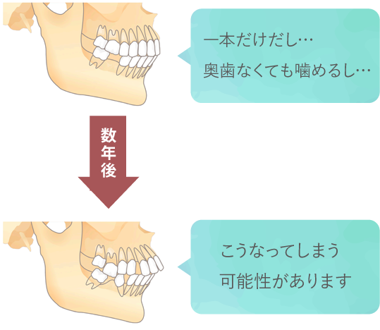 欠損歯の放置